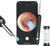 Изображение Bebird Otoskop z kamer do czyszczenia uszu Bebird R1 (czarny)