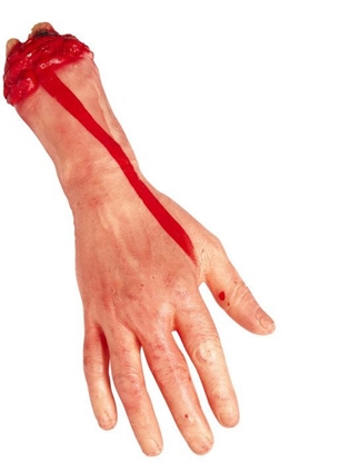 Picture of Blodig afrevet hånd