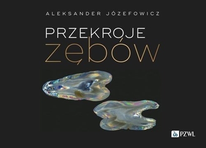 Изображение PZWL Przekroje zbów
