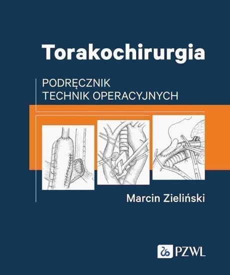 Изображение PZWL Torakochirurgia
