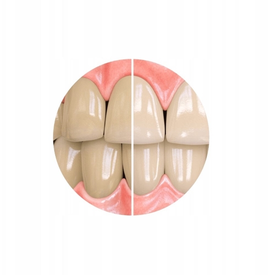 Picture of Sensitivity Relief Whitening Toothpaste (PdZ,UNI,100)