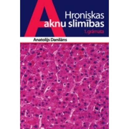 Attēls no  Hroniskas aknu slimības 1. grāmata