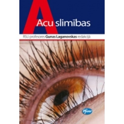 Attēls no Acu slimības