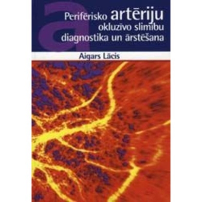 Attēls no Perifērisko artēriju okluzīvo slimību diagnostika un ārstēšana