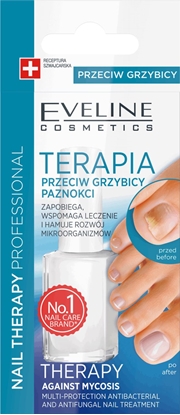 Изображение Eveline Nail Therapy Lakier Terapia przeciw grzybicy paznokci stóp 12ml